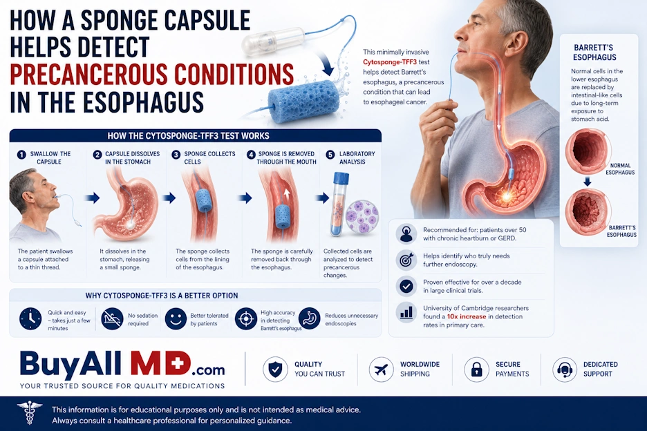 Cytosponge capsule test for Barrett's esophagus — a minimally invasive sponge test for early detection