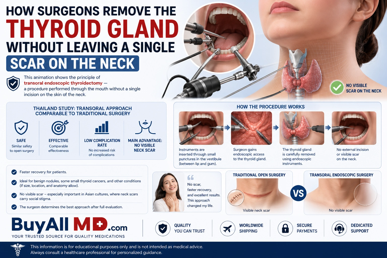 Transoral endoscopic thyroidectomy — scarless thyroid surgery through the mouth without neck incisions